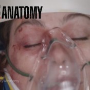 greys-anatomy-meredith-agresse